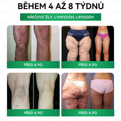 ⭐ 𝐏𝐙𝐆𝐎𝐍𝐄® Superpotravinová Nano mikroneedle náplast | 🎁 Zbývá pouze 10 boxů! 🎁 Dáváme další 40% slevu! Pečujte o své zdraví! Pokud teď propásnete, letos už nebude žádná příležitost!