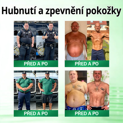 🇨🇿 Oficiální obchod | 💯 PZGONE® Moringa·Berberine×NAD+ 10v1 Náplast (Okamžitý účinek, 7 dní viditelná transformace)✅ Řešení pro: Obezita, ochablá pokožka, diabetes, spánková apnoe, kloubní potíže.