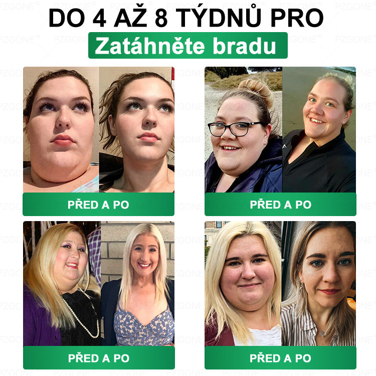 ⭐ 𝐏𝐙𝐆𝐎𝐍𝐄® Superpotravinová Nano mikroneedle náplast | 🎁 Zbývá pouze 10 boxů! 🎁 Dáváme další 40% slevu! Pečujte o své zdraví! Pokud teď propásnete, letos už nebude žádná příležitost!