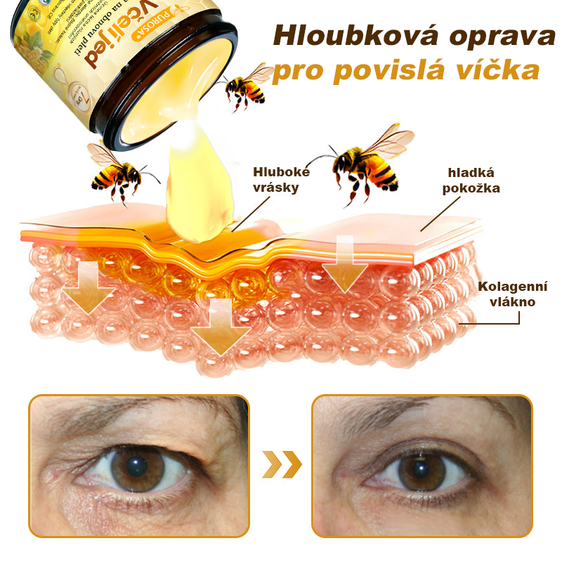🐝PUROSA® Obnovující krém s včelím jedem｜✅Kompletní řešení pro odolné kožní problémy, jako je stárnutí, ekzém, jizvy a lupénka