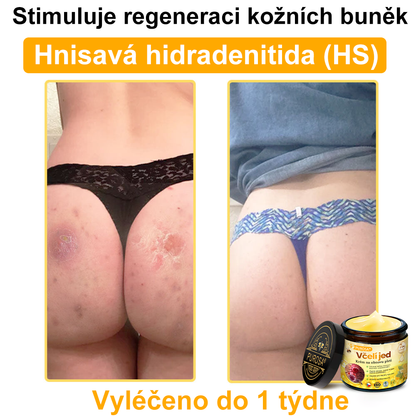 🐝PUROSA® Obnovující krém s včelím jedem｜✅Kompletní řešení pro odolné kožní problémy, jako je stárnutí, ekzém, jizvy a lupénka