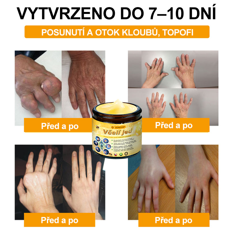 ⭐🎁 Zůstalo jen 10 balení! 🎁 Dáváme dodatečnou slevu 40%! Pečujte o své zdraví! Pokud to teď propásnete, letos už nebude žádná další příležitost!