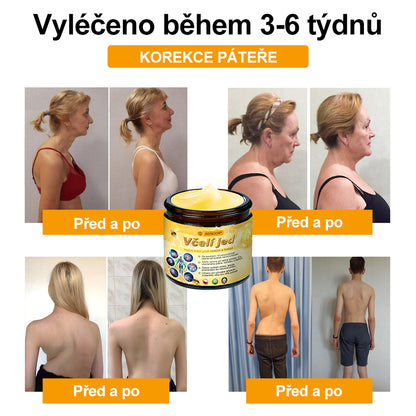 ⭐🎁 Zůstalo jen 10 balení! 🎁 Dáváme dodatečnou slevu 40%! Pečujte o své zdraví! Pokud to teď propásnete, letos už nebude žádná další příležitost!