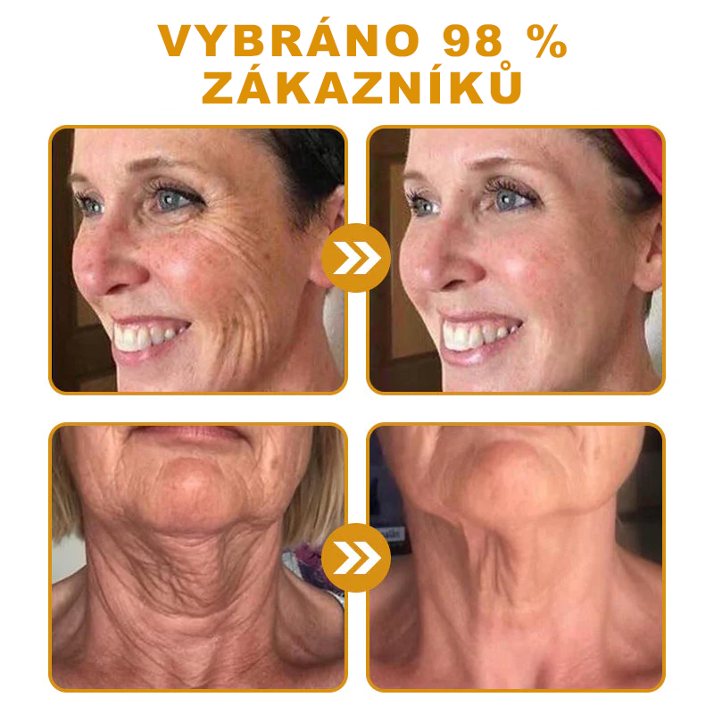 🐝PUROSA® Obnovující krém s včelím jedem｜✅Kompletní řešení pro odolné kožní problémy, jako je stárnutí, ekzém, jizvy a lupénka