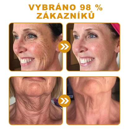 🐝PUROSA® Obnovující krém s včelím jedem｜✅Kompletní řešení pro odolné kožní problémy, jako je stárnutí, ekzém, jizvy a lupénka