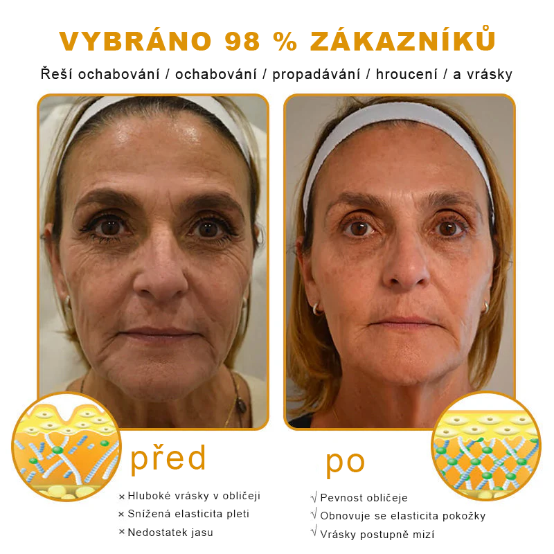 🐝PUROSA® Obnovující krém s včelím jedem｜✅Kompletní řešení pro odolné kožní problémy, jako je stárnutí, ekzém, jizvy a lupénka