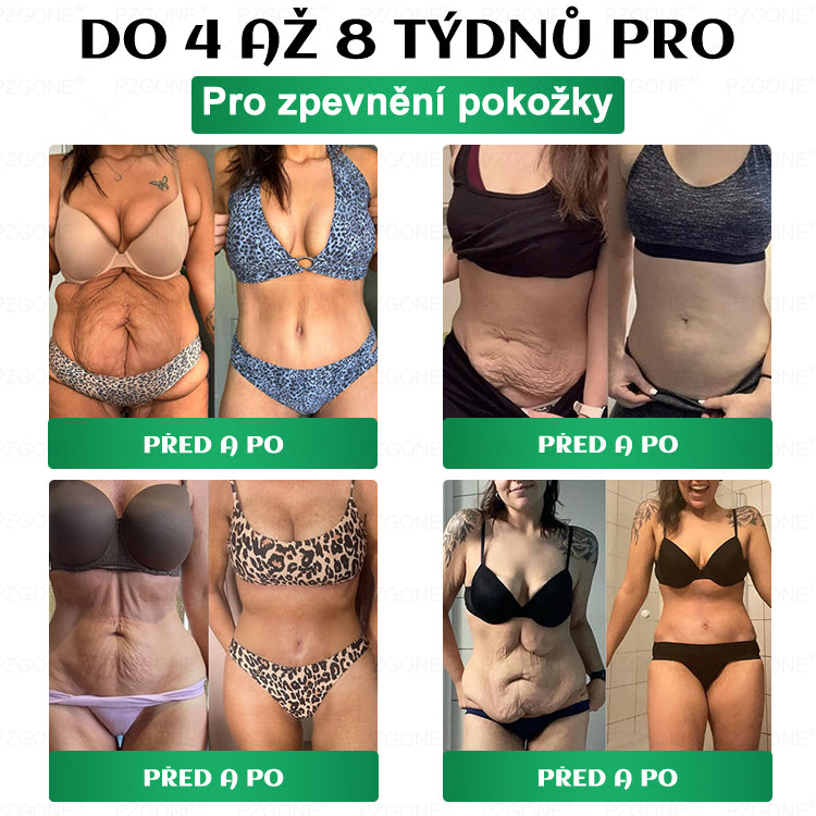 ⭐ 𝐏𝐙𝐆𝐎𝐍𝐄® Superpotravinová Nano mikroneedle náplast | 🎁 Zbývá pouze 10 boxů! 🎁 Dáváme další 40% slevu! Pečujte o své zdraví! Pokud teď propásnete, letos už nebude žádná příležitost!